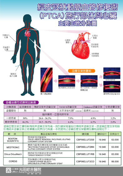 经֫a状动脉ޭ`术(PTCA)