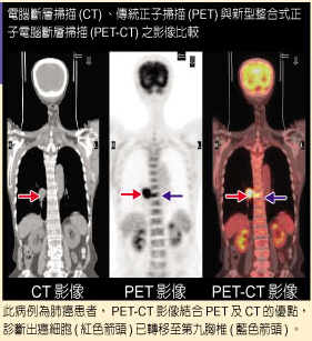 ���l电脑断层扫�y仪