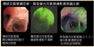 �����e�f筛检