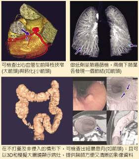 �h����计����断层扫�y仪